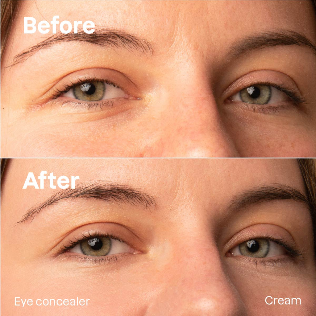 Concealer